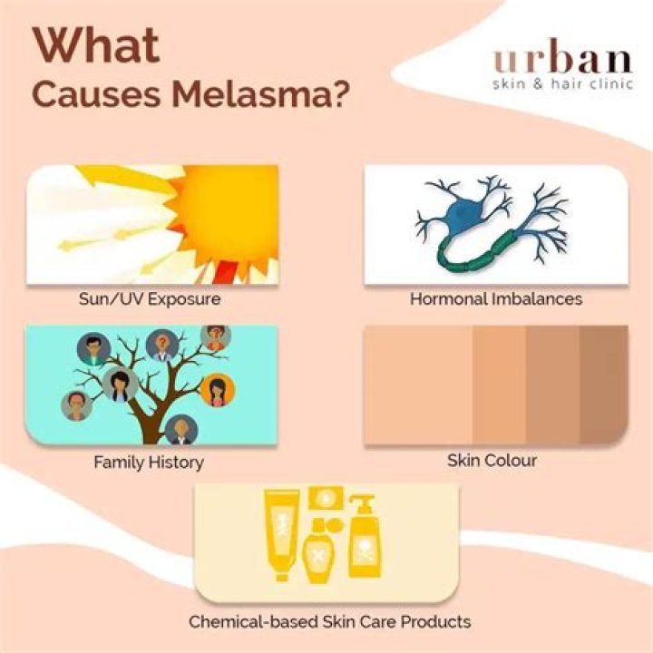 What deficiency causes melasma?